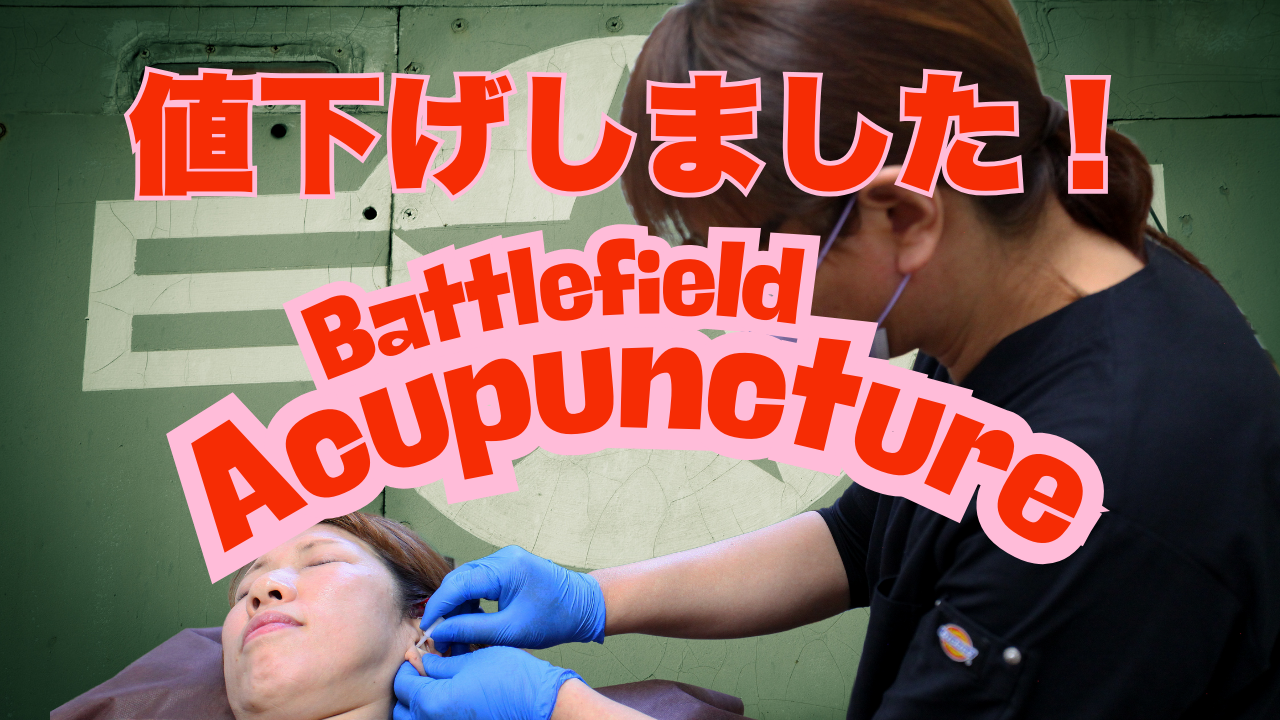 ASP®を使用した戦場鍼（BFA）について価格改定のお知らせ！ | 松浦鍼灸院 | 長野県飯田市の老舗鍼灸院